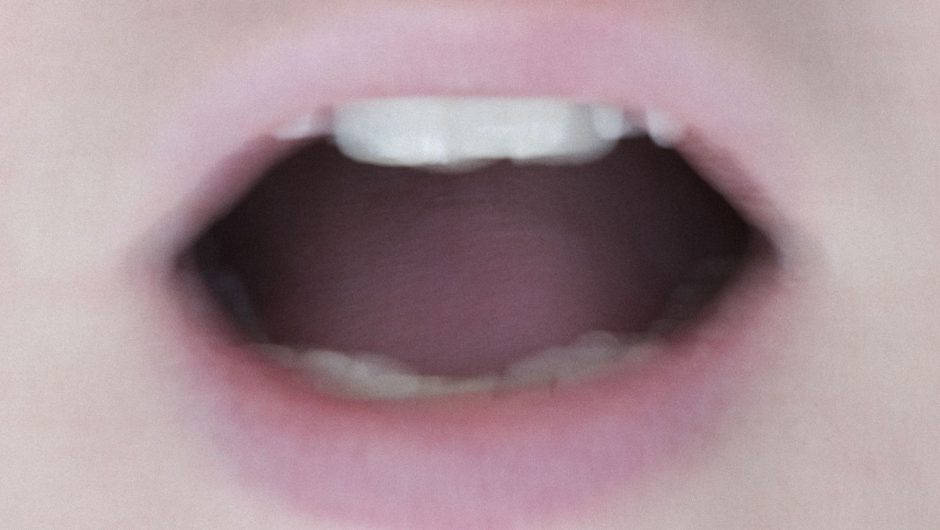 ‘Covid tongue’ may be another coronavirus symptom, researcher suggests