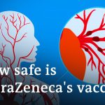 Does the AstraZeneca COVID vaccine cause blood clots? | DW News